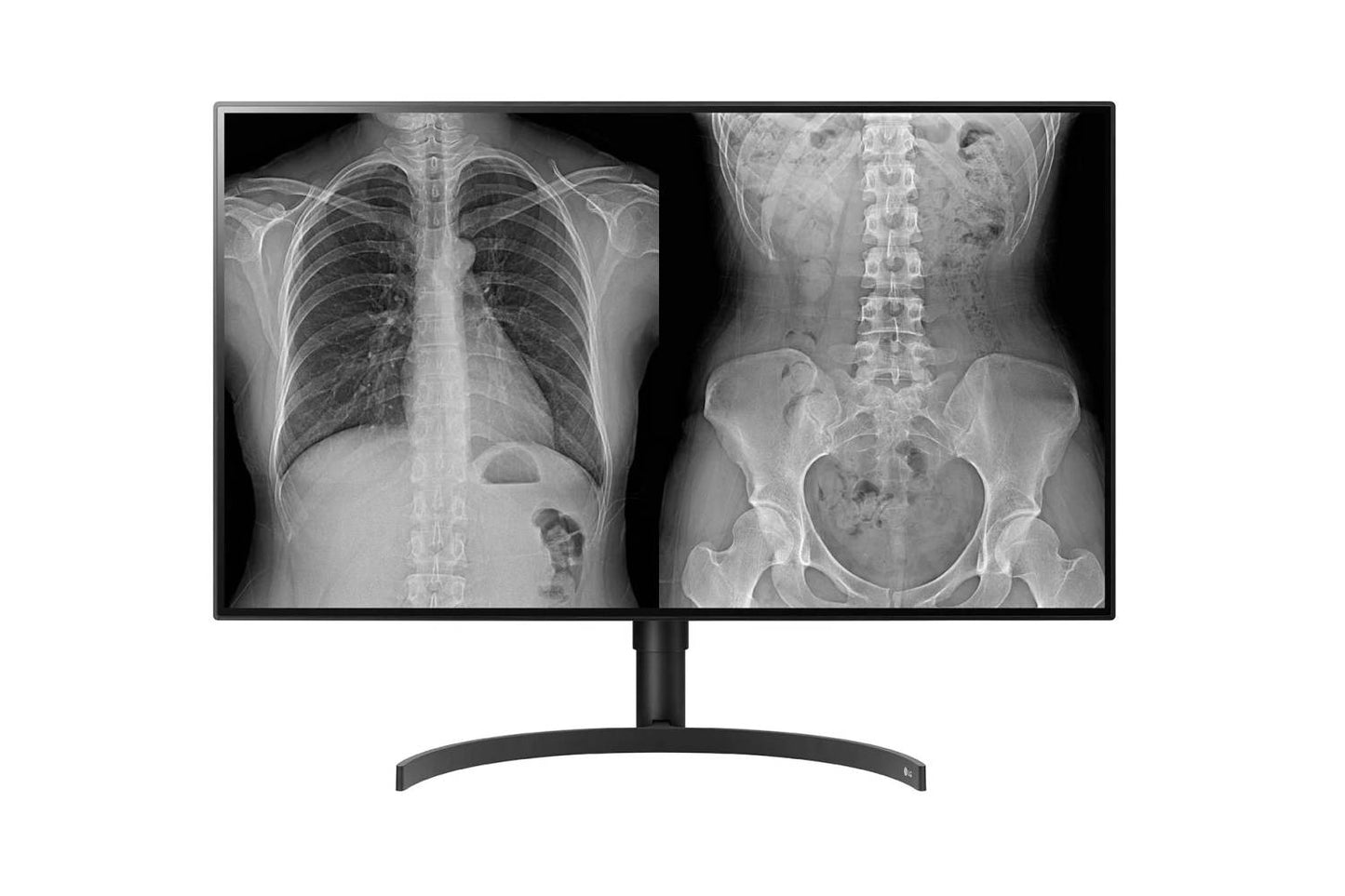 LG 31.5 (80.01cm) UHD 8MP Diagnostic Monitor